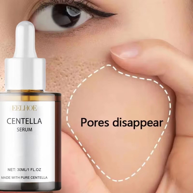 Luxury Skincare Korea - Suero Facial con Centella Asiática para