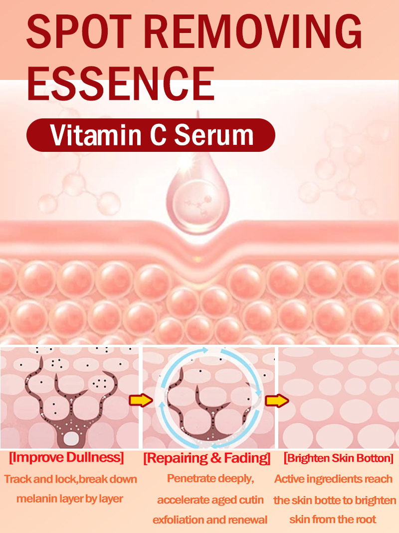 Ilumina las pecas Melasma, las - Luxury Skincare Essence reseña y precio