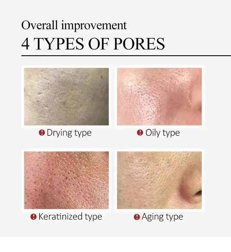 Suero Facial con Centella Asiá - Luxury Skincare Korea reseña y precio