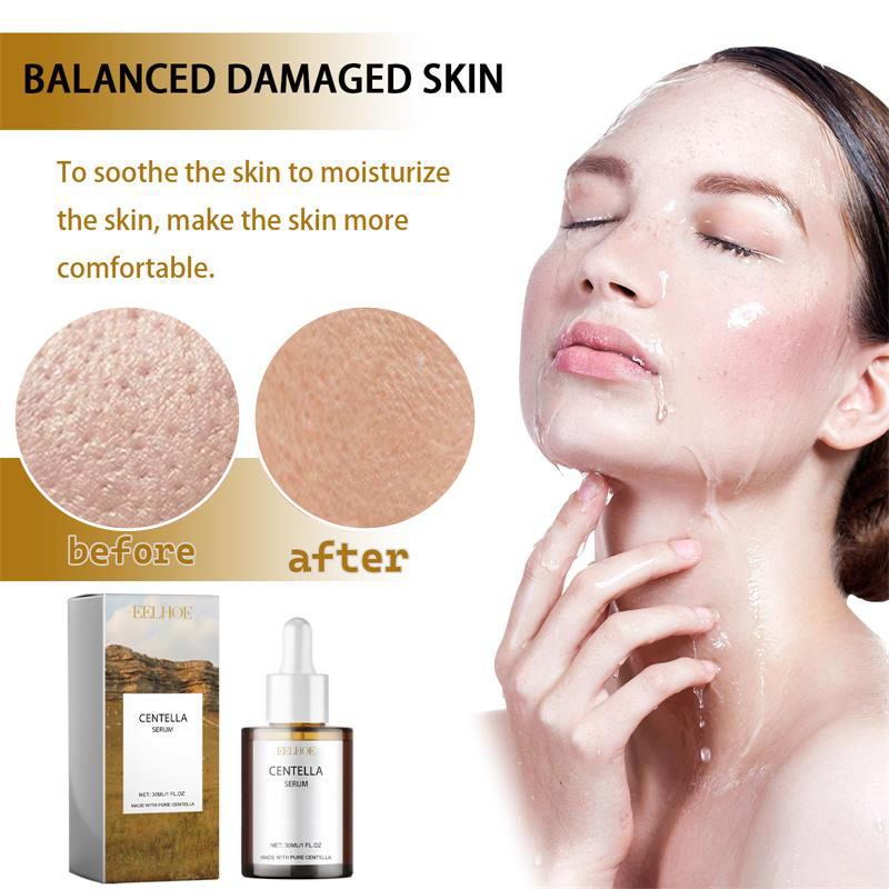 Suero Facial con Centella Asiá - Luxury Skincare Korea reseña y precio
